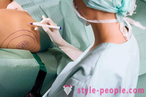Plastisch chirurgen vernietigen stereotypen over hun werk
