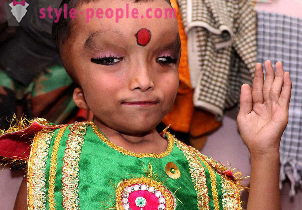 Het Indische dorp wordt aanbeden jongen met een misvormd hoofd als een god Ganesha