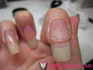 Hoe kan acryl nagels te verwijderen thuis? Het verwijderen van acryl nagels: beoordelingen